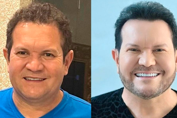 Ximbinha - Foto: Reprodução/ Instagram