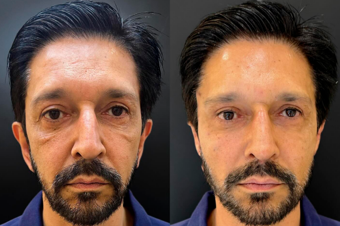 Ricardo Nunes - Foto: Divulgação/ JK Estética